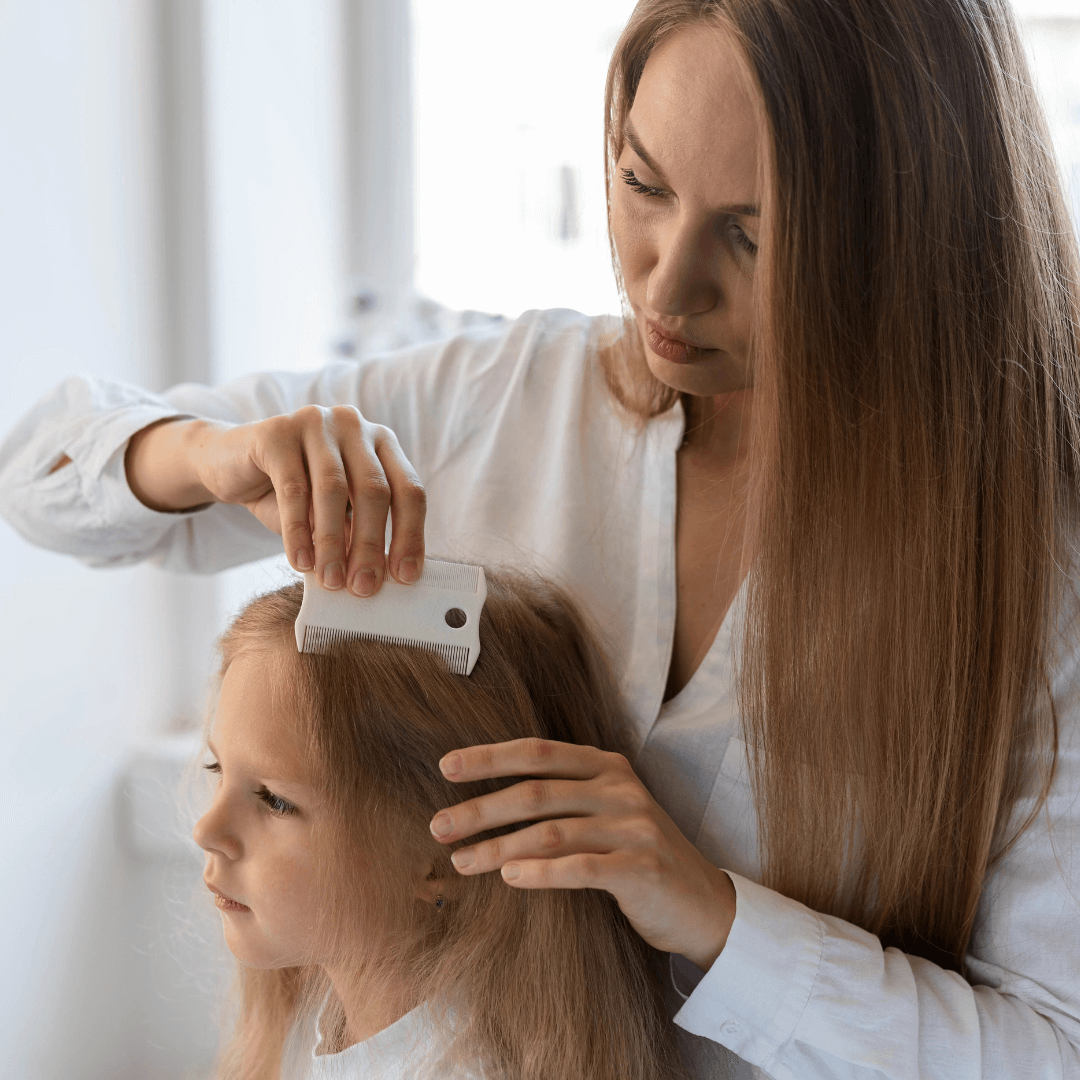 Louse Buster Prevenzione e soluzione